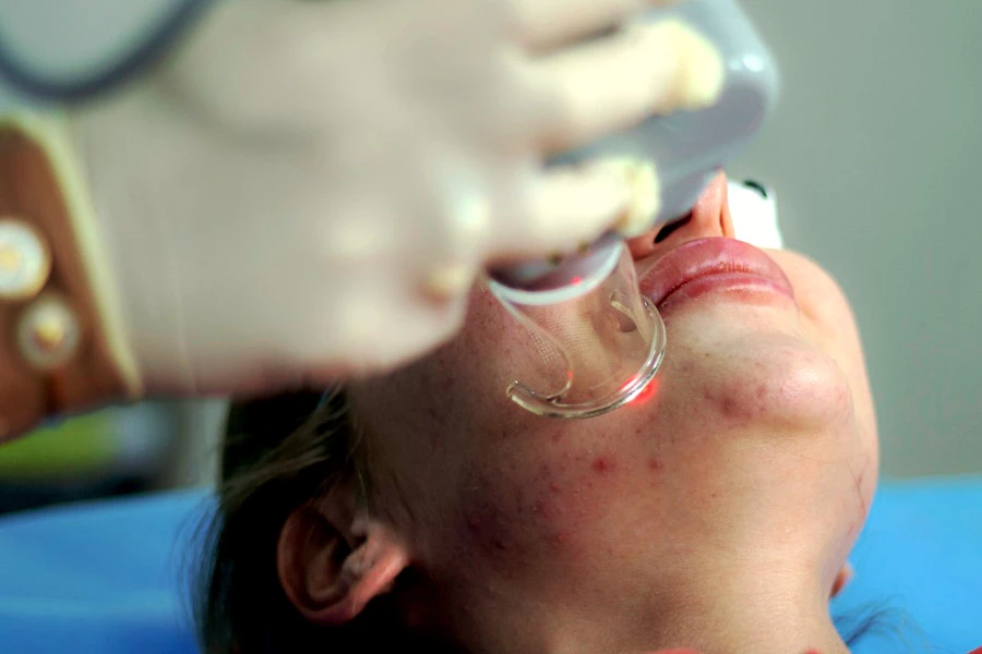 Sensitive Skin Treatment with a Dermatologist: A photograph of a dermatologist treating a patient.